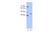 Antibody used in WB on Human Jurkat 0.2-1 ug/ml.