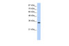 Antibody used in WB on Human Jurkat cells at 0.2-1 ug/ml.