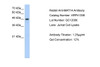 Antibody used in WB on Human Jurkat 1.25 ug/ml.