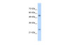 Antibody used in WB on Human Jurkat 2.5 ug/ml.