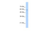 Antibody used in WB on Human Jurkat 2.5 ug/ml.