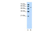 Antibody used in WB on Human Jurkat 1.25 ug/ml.