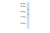 Antibody used in WB on Human Liver at 2.5 ug/ml.