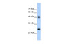 Antibody used in WB on Human HepG2 at 5.0 ug/ml.