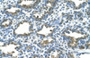 Antibody used in IHC on Human lung at 4.0-8.0 ug/ml.