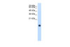 Antibody used in WB on Human HepG2 at 1.25 ug/ml.