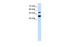 Antibody used in WB on Human HT1080 at 2.5 ug/ml.