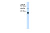 Antibody used in WB on Human Jurkat 0.2-1 ug/ml.