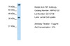 Antibody used in WB on Human Jurkat 1 ug/ml.