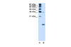 Antibody used in WB on Human K562 at 1.25 ug/ml.