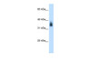 Antibody used in WB on Human Placenta at 0.2-1 ug/ml.