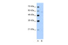 Antibody used in WB on Human Jurkat 5.0 ug/ml.