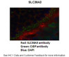 Antibody used in IHC on Mouse retina-outer plexiform layer at s 1:200.