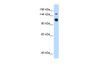 Antibody used in WB on Human HepG2 at 0.25 ug/ml.