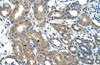 Antibody used in IHC on Human kidney.