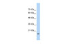 Antibody used in WB on Human HepG2 at 2.5 ug/ml.