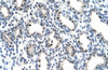 Antibody used in IHC on Human Lung.
