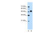 Antibody used in WB on Human Jurkat 1.25 ug/ml.