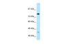 Antibody used in WB on Human Jurkat 0.2-1 ug/ml.