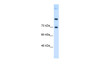 Antibody used in WB on Human HepG2 at 0.125 ug/ml.