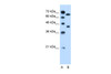 Antibody used in WB on Human Jurkat 0.2-1 ug/ml.