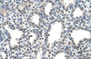 Antibody used in IHC on Human Lung.