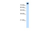 Antibody used in WB on Human HepG2 at 1.25 ug/ml.