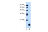 Antibody used in WB on Human HepG2 at 1.25 ug/ml.