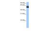 Antibody used in WB on Human brain at 0.2-1 ug/ml.