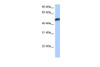 Antibody used in WB on Human MCF-7 at 0.2-1 ug/ml.