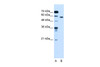 Antibody used in WB on Human Jurkat 0.2-1 ug/ml.