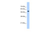 Antibody used in WB on Human HepG2 at 0.25 ug/ml.