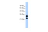 Antibody used in WB on Human 721_B at 0.2-1 ug/ml.