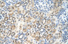 Antibody used in IHC on Human kidney.