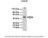Antibody used in WB on Human fibroblast mitochondria at: 1:1000.