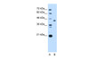 Antibody used in WB on Human HepG2 at 0.25 ug/ml.