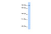 Antibody used in WB on Transfected 293T at 0.2-1 ug/ml.