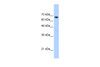 Antibody used in WB on Human Jurkat 0.2-1 ug/ml.