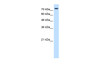 Antibody used in WB on Human HepG2 at 0.2-1 ug/ml.