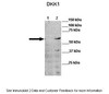 Antibody used in WB on Human cell lines at: 1:1000 (Lane 1: 30ug human PLC/PRF5 cell lysate, Lane 2: 30ug DKK1 PLC/PRF5 cell lysate ) .