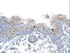 Antibody used in IHC on Human HepG2.