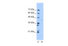 Antibody used in WB on Human HepG2 at 5.0 ug/ml.