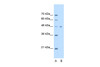 Antibody used in WB on Human HepG2 cells at 2.5 ug/ml.