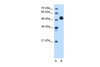 Antibody used in WB on Human HepG2 at 1.25 ug/ml.