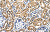 Antibody used in IHC on Human kidney.