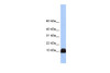 Antibody used in WB on Human Liver at 0.2-1 ug/ml.