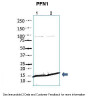 Antibody used in WB on Human at: 1:2000 (Lane 1. 20 ug human pregnant uterine muscle cells + hormone Lane 2. 20 ug human pregnant uterine muscle cells - hormone) .