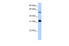 Antibody used in WB on Human HeLa at 0.2-1 ug/ml.