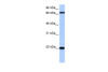 Antibody used in WB on Human Jurkat 0.2-1 ug/ml.