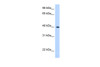 Antibody used in WB on Human LN18 at 0.2-1 ug/ml.